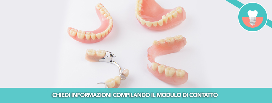 Implantoprotesi per il recupero degli elementi dentali