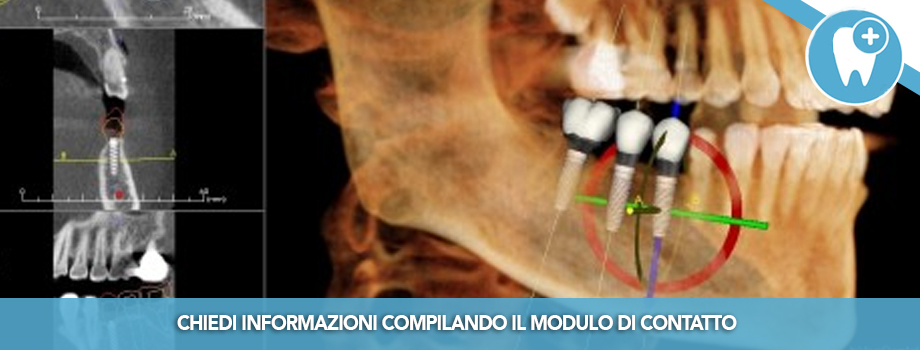 Gli esami tridimensionali radiologici in odontoiatria: vantaggi e caratteristiche delle CBCT